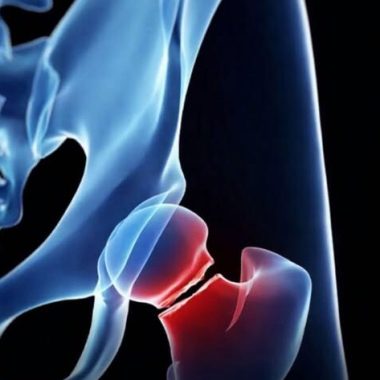 The five drinks that are most harmful to your bones, according to health experts