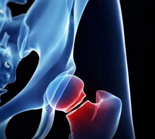 The five drinks that are most harmful to your bones, according to health experts